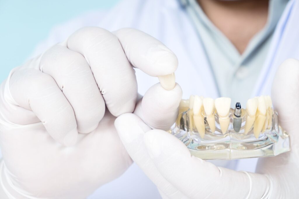 Dentist wearing white gloves holding sample dental implant with clear base